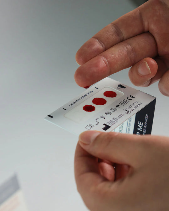 Vitamin D Test